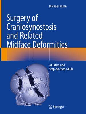 cover image of Surgery of Craniosynostosis and Related Midface Deformities